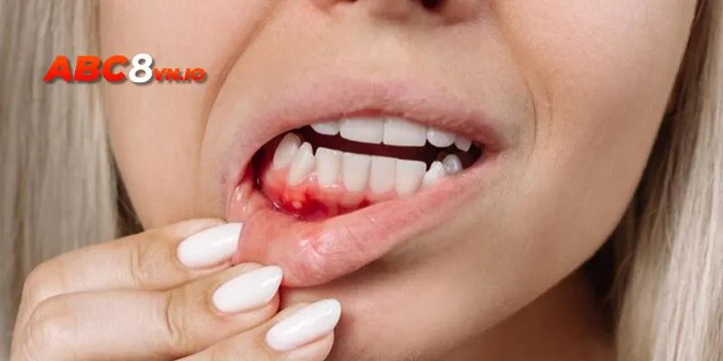 Nằm Mơ Thấy Máu - Chi Tiết Ý Nghĩa Giấc Mơ Đặc Biệt Mơ chảy máu răng thể hiện điềm báo nguy hiểm về thể trạng, trực khỏe